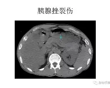 納貢遭受腹部傷勢，損失無法突破